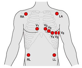 Diagnostyka kardiologiczna